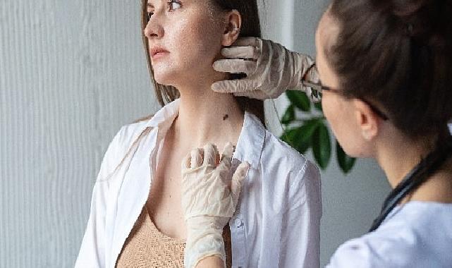 15 Eylül Dünya Lenfoma Farkındalık Günü