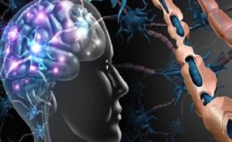 Ülkemizde yaklaşık 50 bin MS hastası var